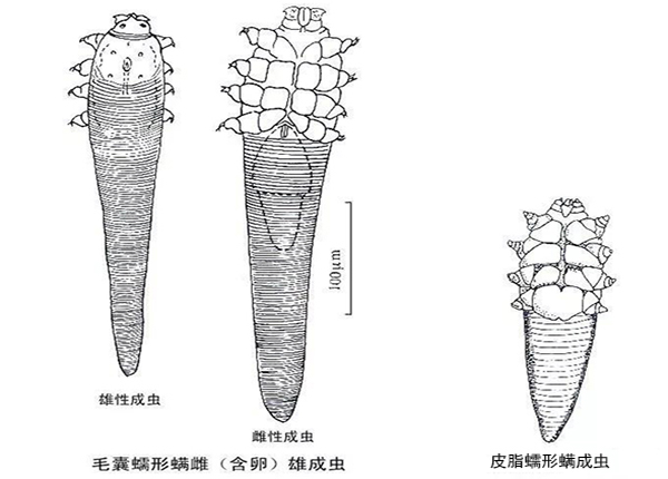 螨蟲(chóng)